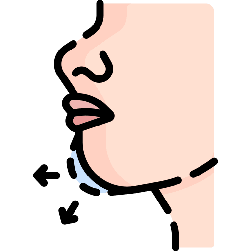 chin implant