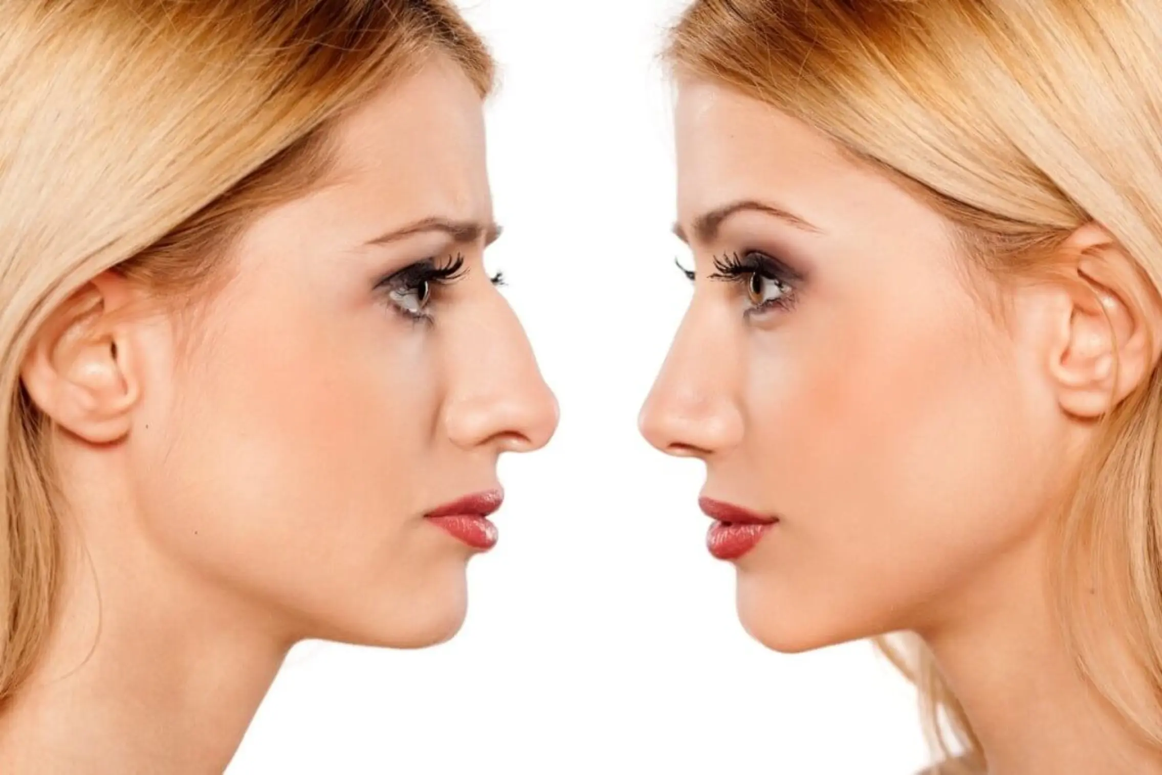 Best Rhinoplasty Clinic in Kolkata — Nose Reshaping, Nose Job and Rhinoplasty Surgery with Natural Results