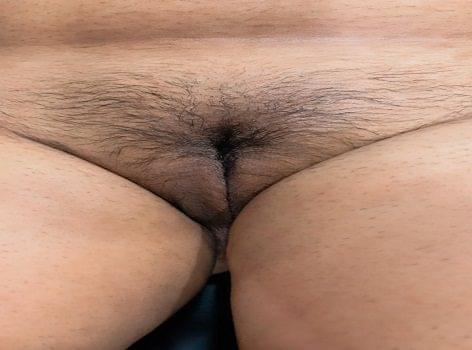 Gender change surgery in Ahmedabad