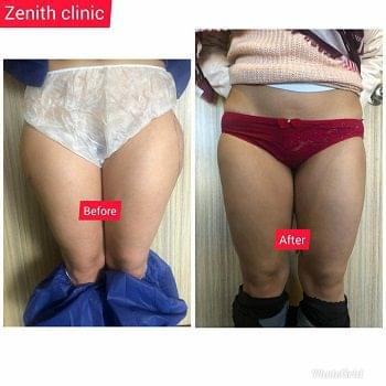 Gender change surgery in Ahmedabad