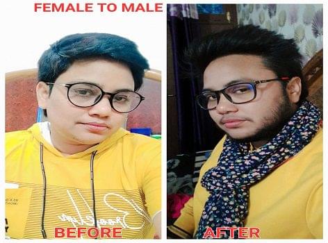 Gender change surgery in Ahmedabad