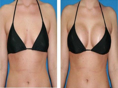 Gender change surgery in Ahmedabad